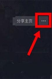 腕上抖音简约版