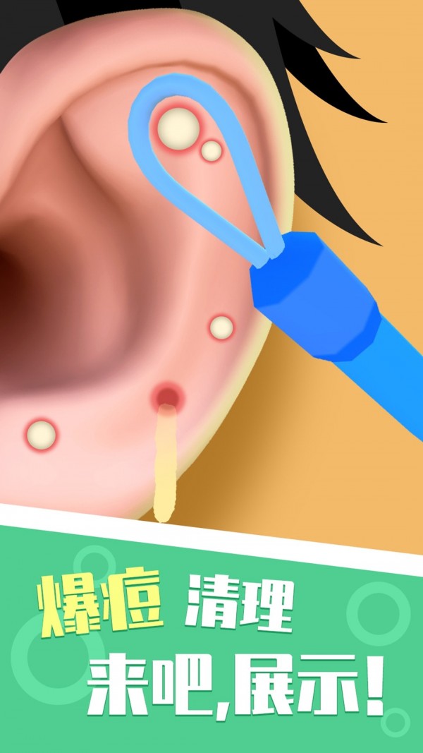你来掏耳屎吧